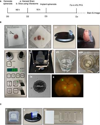 Development and validation of an advanced ex vivo brain slice invasion assay to model glioblastoma cell invasion into the complex brain microenvironment